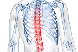 inflamed spine causing back pain